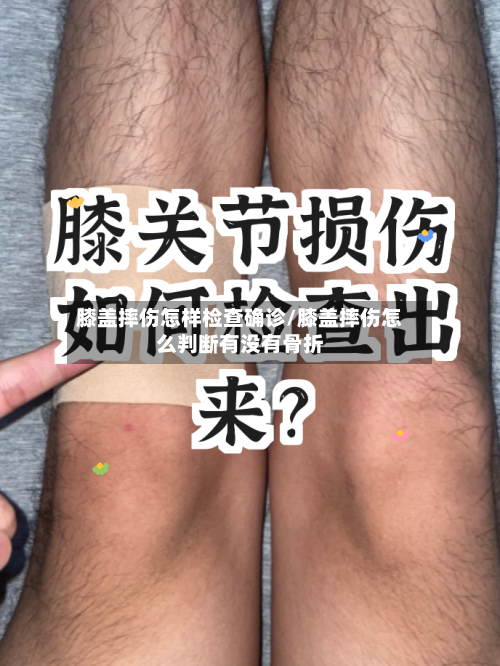 膝盖摔伤怎样检查确诊/膝盖摔伤怎么判断有没有骨折