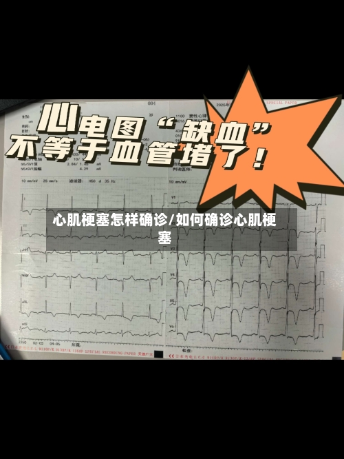 心肌梗塞怎样确诊/如何确诊心肌梗塞