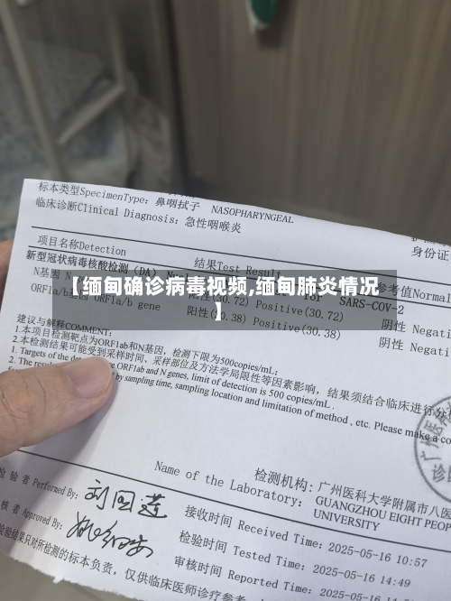 【缅甸确诊病毒视频,缅甸肺炎情况】