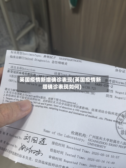英国疫情新增确诊表现(英国疫情新增确诊表现如何)-第2张图片