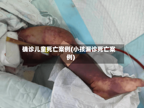 确诊儿童死亡案例(小孩漏诊死亡案例)-第2张图片