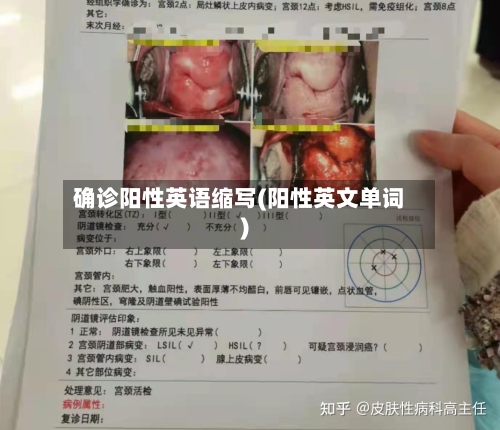 确诊阳性英语缩写(阳性英文单词)