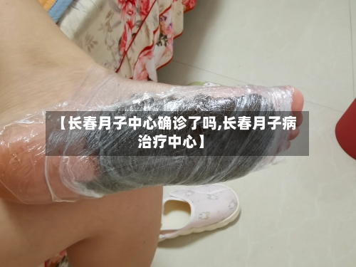 【长春月子中心确诊了吗,长春月子病治疗中心】-第2张图片