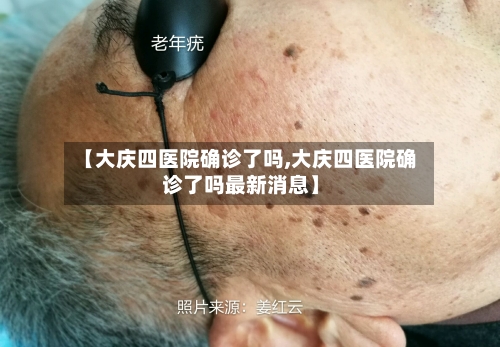 【大庆四医院确诊了吗,大庆四医院确诊了吗最新消息】