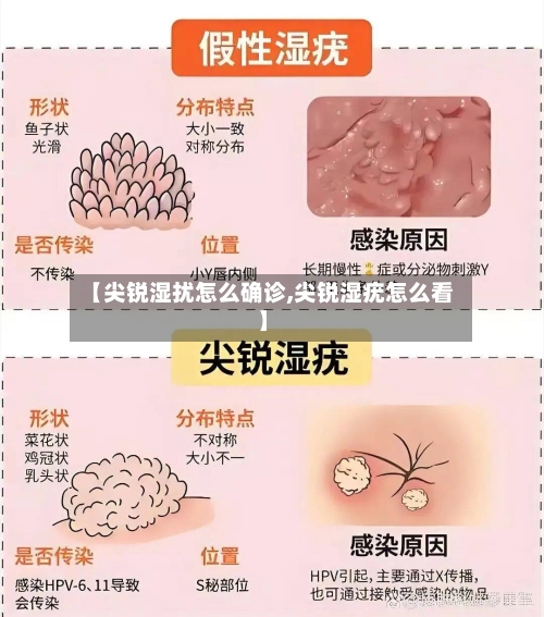 【尖锐湿扰怎么确诊,尖锐湿疣怎么看】